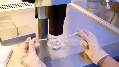 广州试管助孕费用解析：一次大概多少钱？